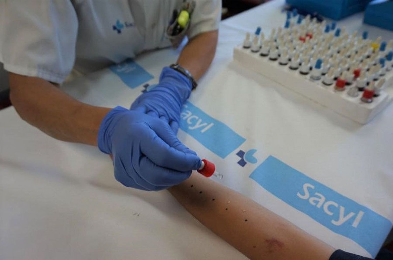 Pruebas alergia hospital